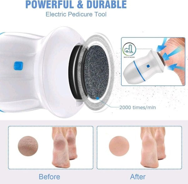 Electric Pedicure Callus Remover - Battery and USB Operated