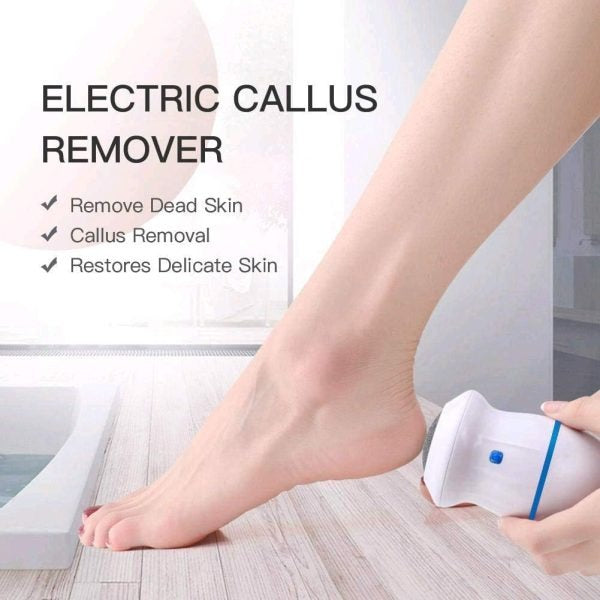 Electric Pedicure Callus Remover - Battery and USB Operated